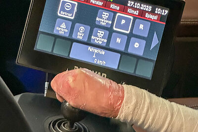 Eine Hand die durch die Schmetterlingskrankheit verwachsen ist, hält einen Joystick fest. Dahinter befindet sich ein aktives Touchdisplay.