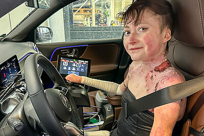 Eine junge leicht lächelnde Dame mit der Schmetterlingskrankheit (offene Hautstellen an Schulter und Hals), sitzt auf dem Fahrersitz angeschnallt, Joystick in der Hand und bereit zum losfahren.
